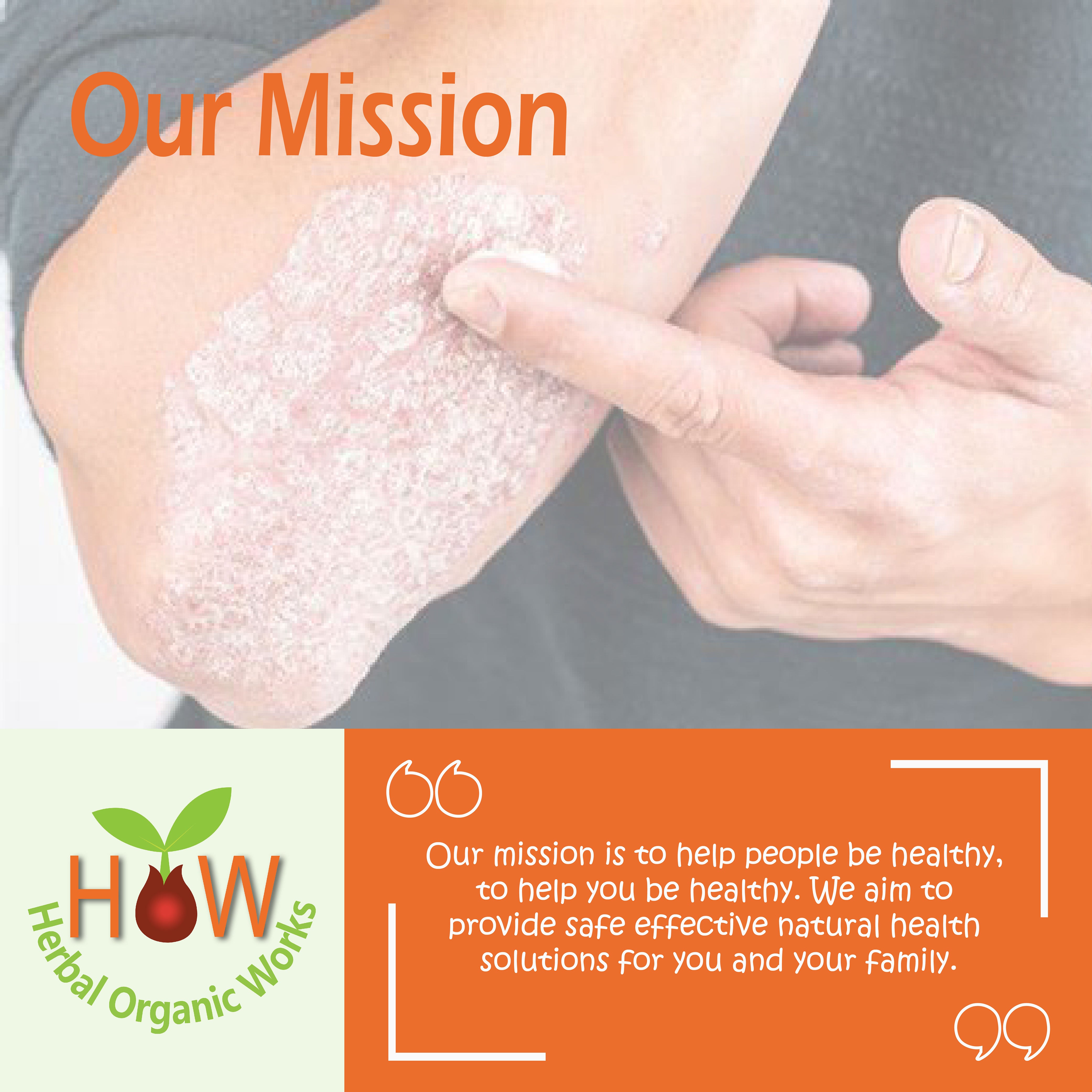 PSORIASIS & SKIN DISORDERS NATURAL REMEDY (HOW7)