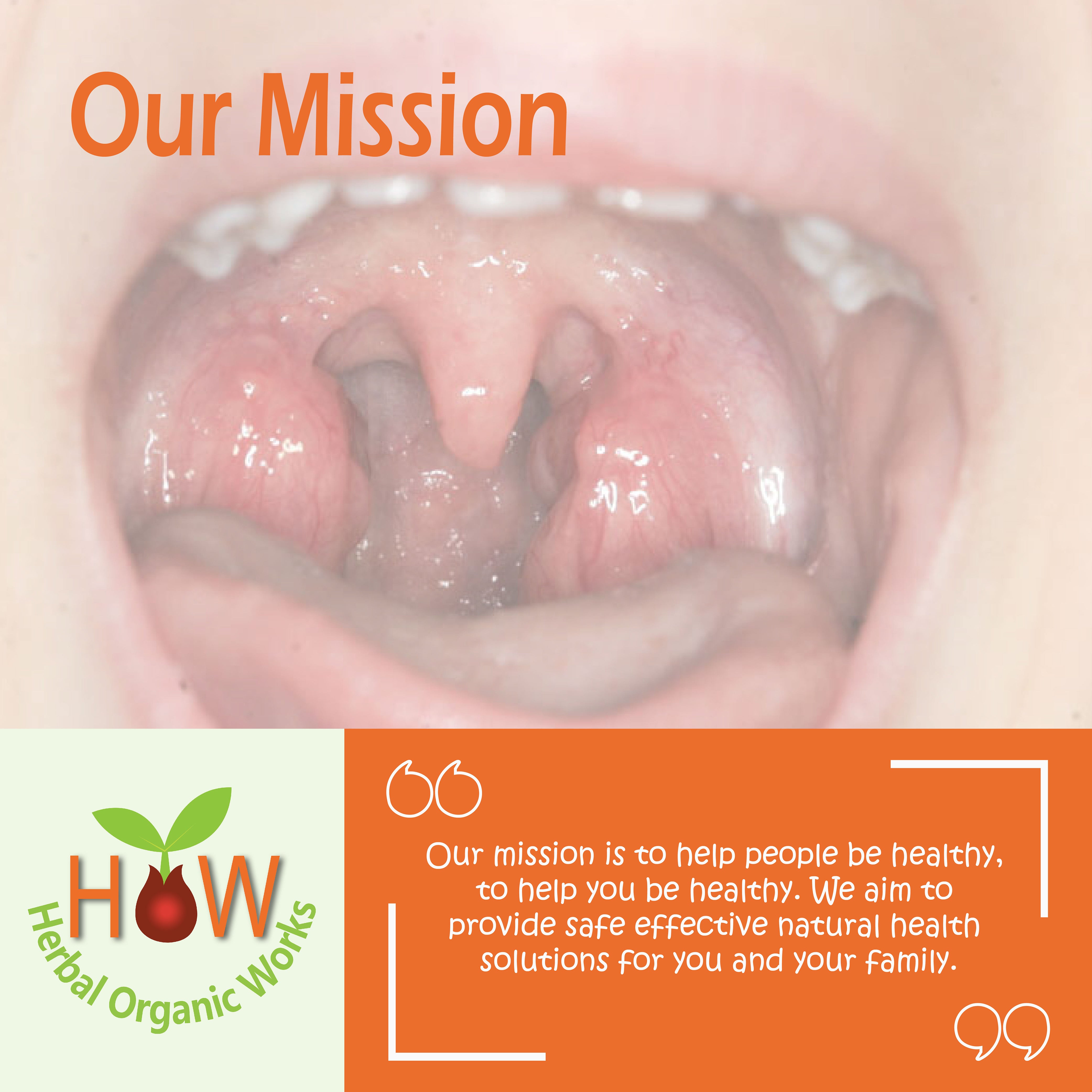 NATURAL REMEDY FOR THROAT INFLAMMATION (HOW225)