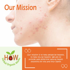 ACNE AND PIMPLES SOLUTION-(HOW38)