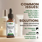 Babchi Oil – Pure Herbal Cold-Pressed for Hair & Skin | 1 oz