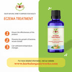 ECZEMA SUPPLEMENT (HOW111)