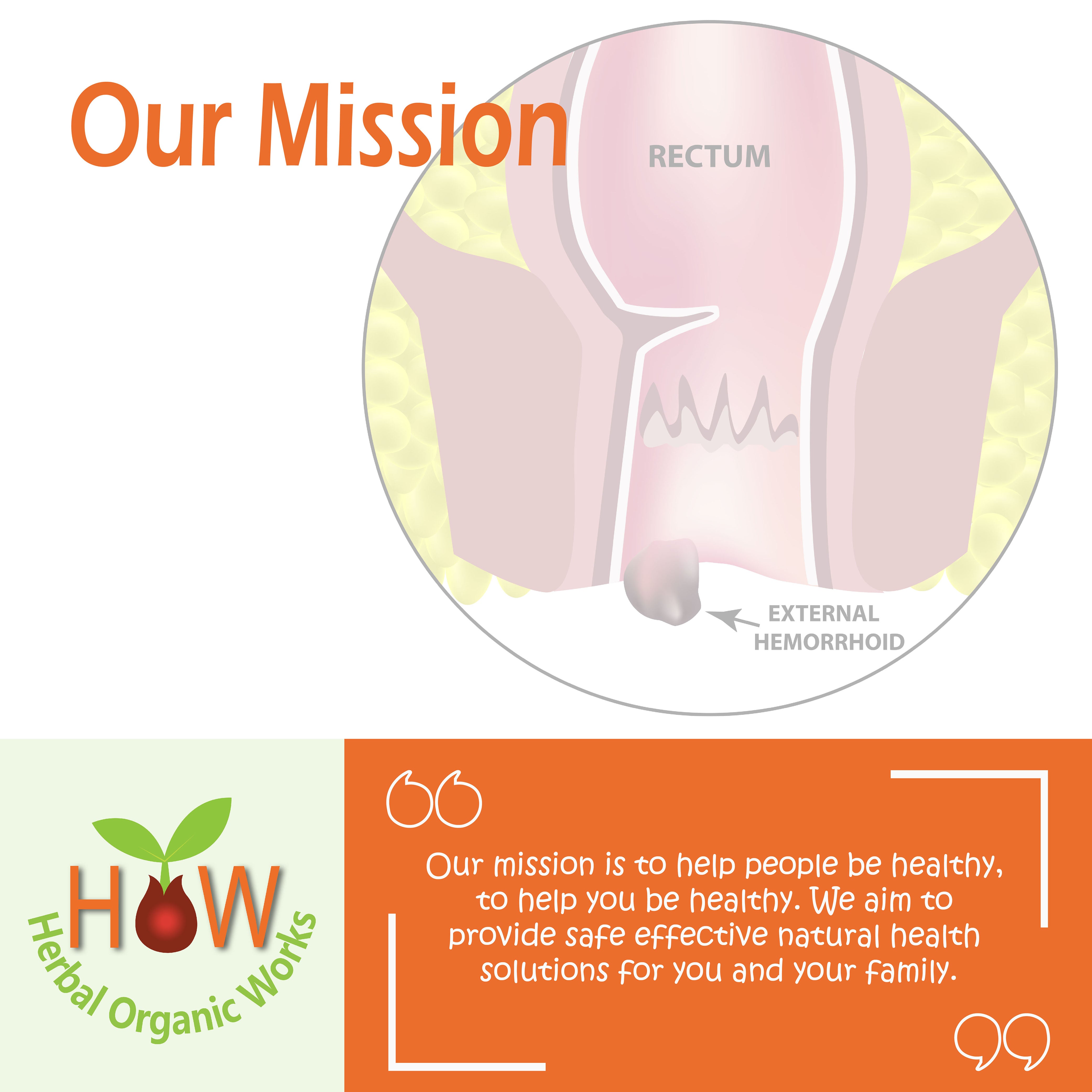 NATURAL REMEDY FOR HEMORRHOIDS | 300 PELLETS (BIO17)