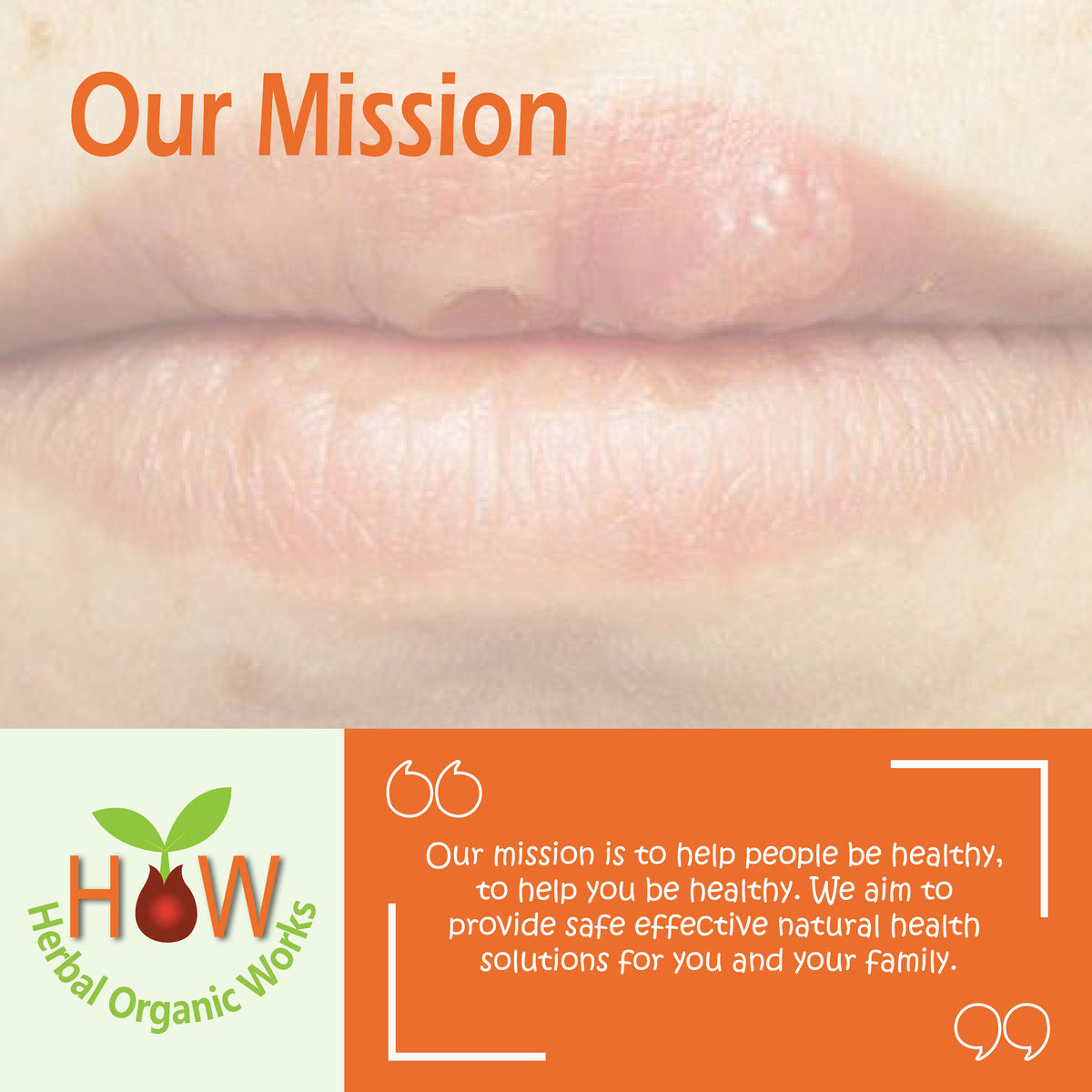 MOUTH SORES TREATEMENT (HOW115)