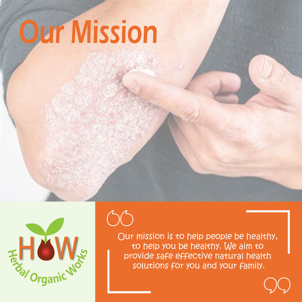 PSORIASIS & SKIN DISORDERS NATURAL REMEDY (HOW7)