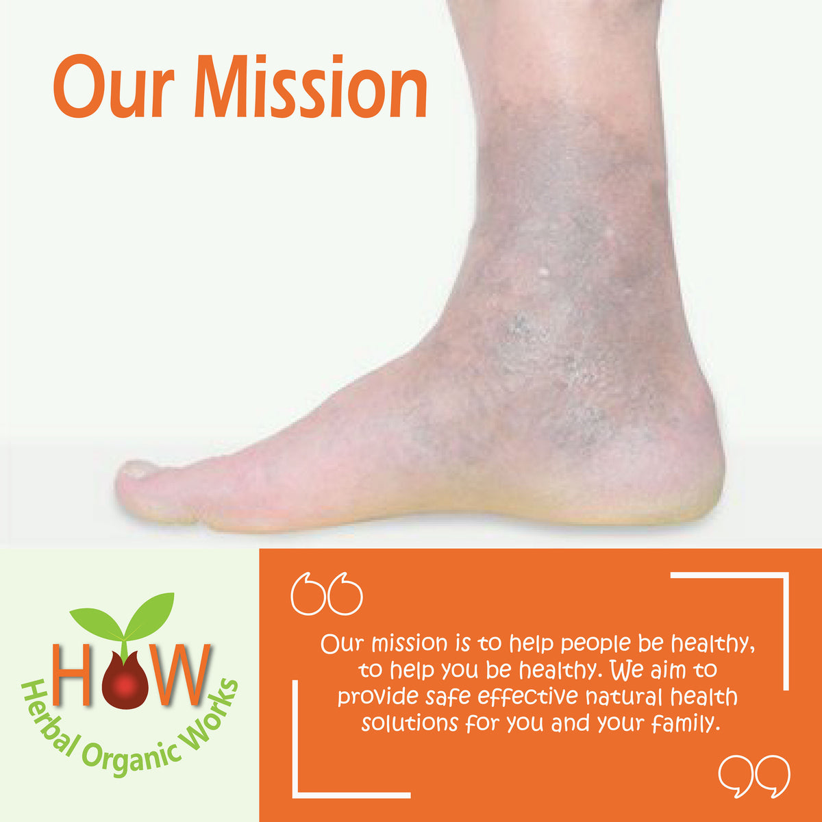 VARICOSE VEINS & ULCERS REMEDY (HOW31)