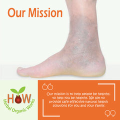 VARICOSE VEINS & ULCERS REMEDY (HOW31)